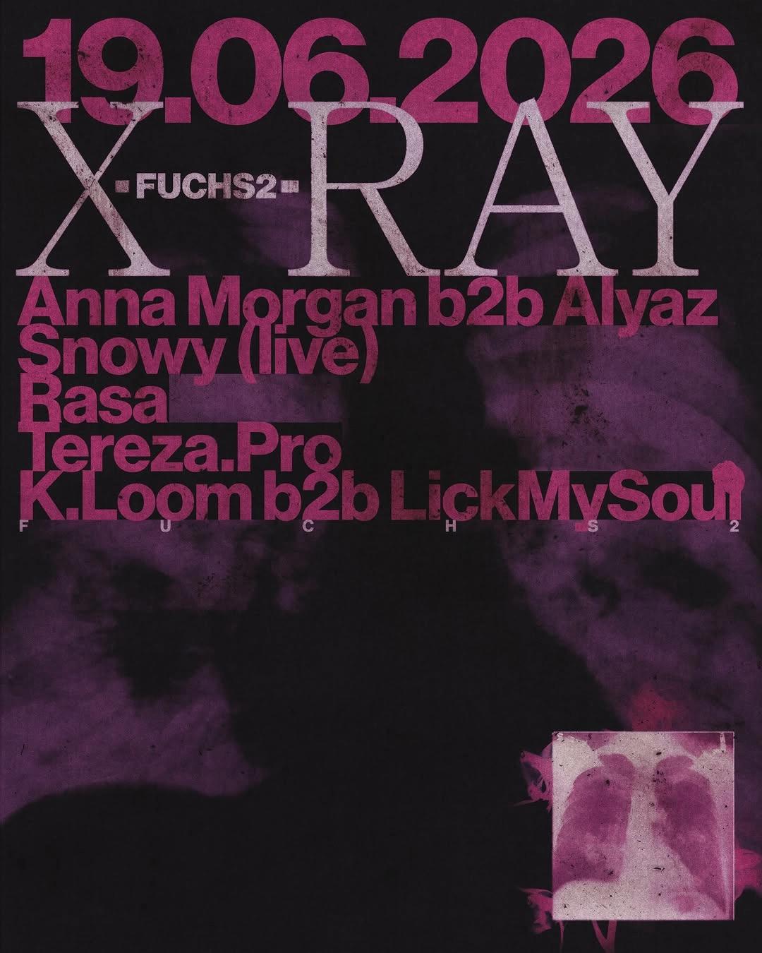 X-Ray at Fuchs2