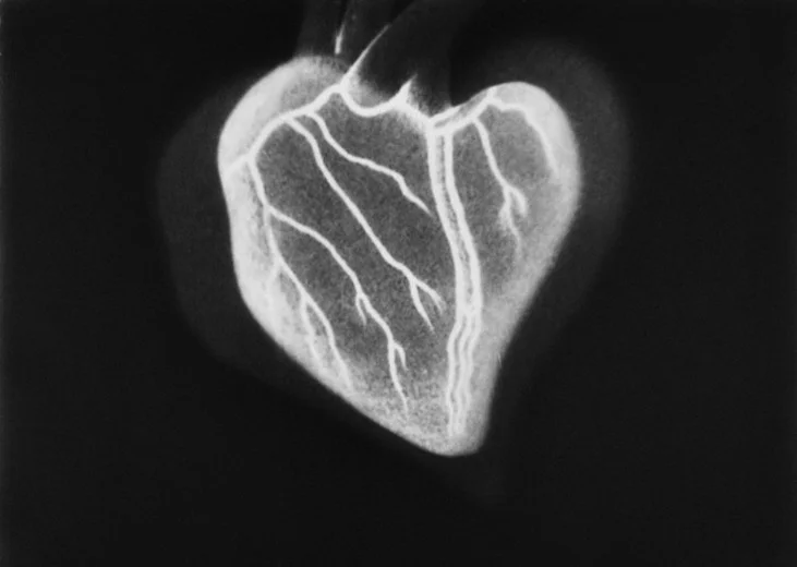 Antifascism, motstånd och queera uttryck i Centraleuropa